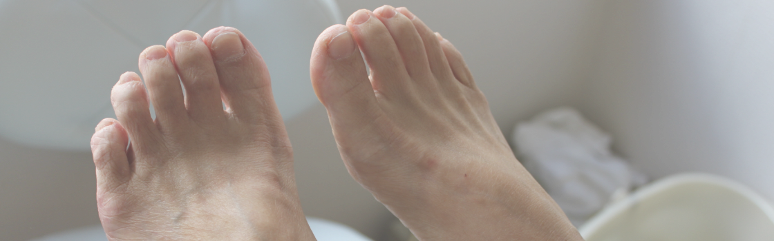 フットケアの現状